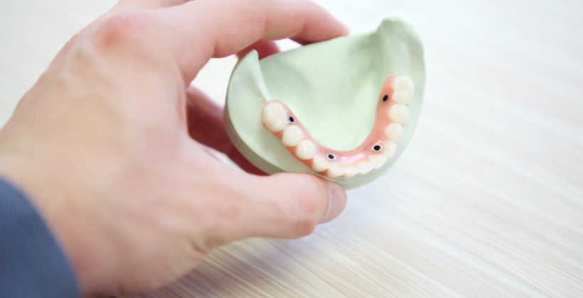 How Mini Dental Implants Can Help