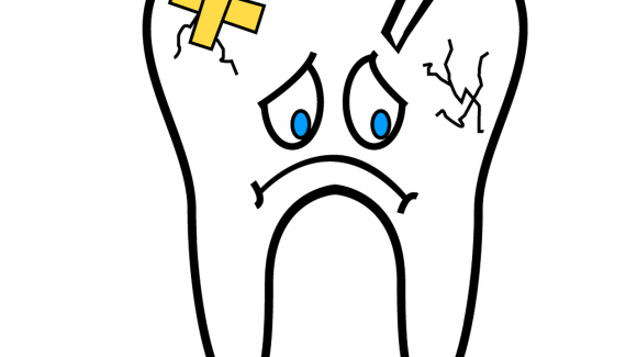 A Cracked or Broken Tooth A Cracked or Broken Tooth
