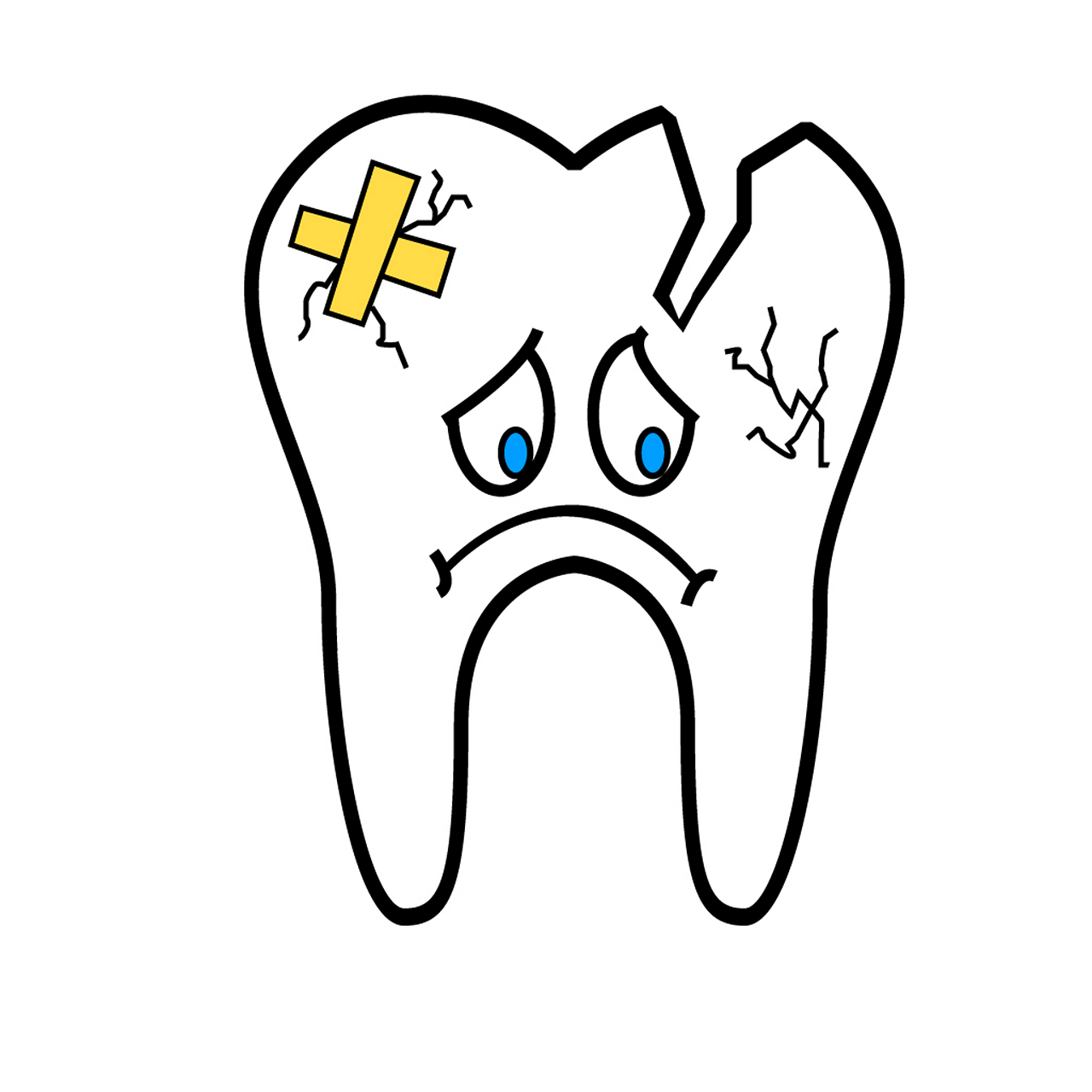 broken-tooth-2351797_1280