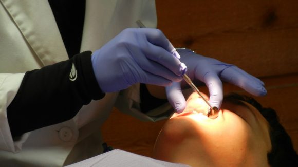 An Abscessed Tooth An Abscessed Tooth