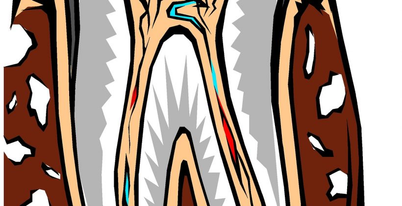 Root Canal – What’s True?